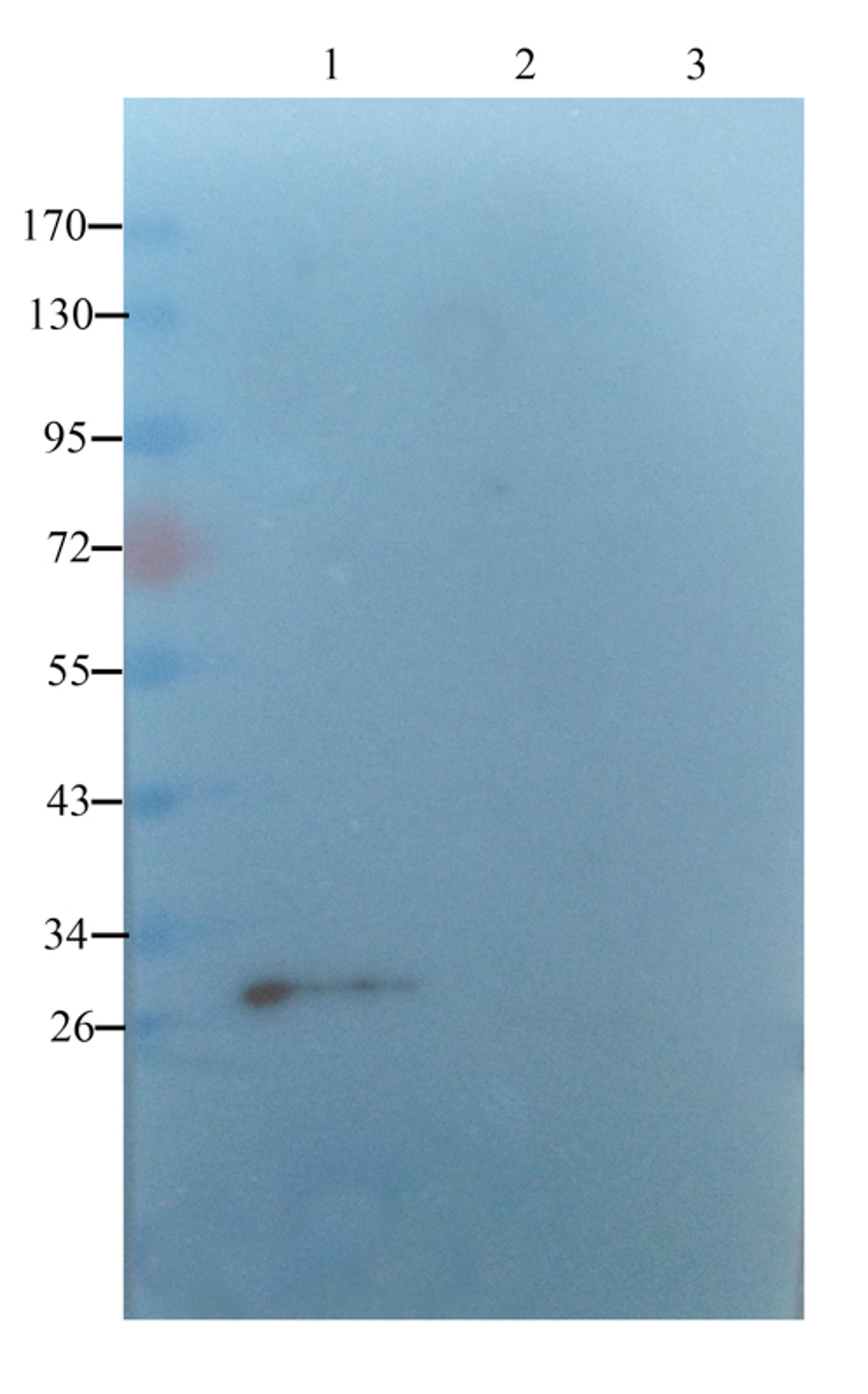 WB analysis of rar uterus (lane 1),rat ovary (lane 2),rat thyriod (lane 3) using SERPING1 antibody (1 ug/ml)