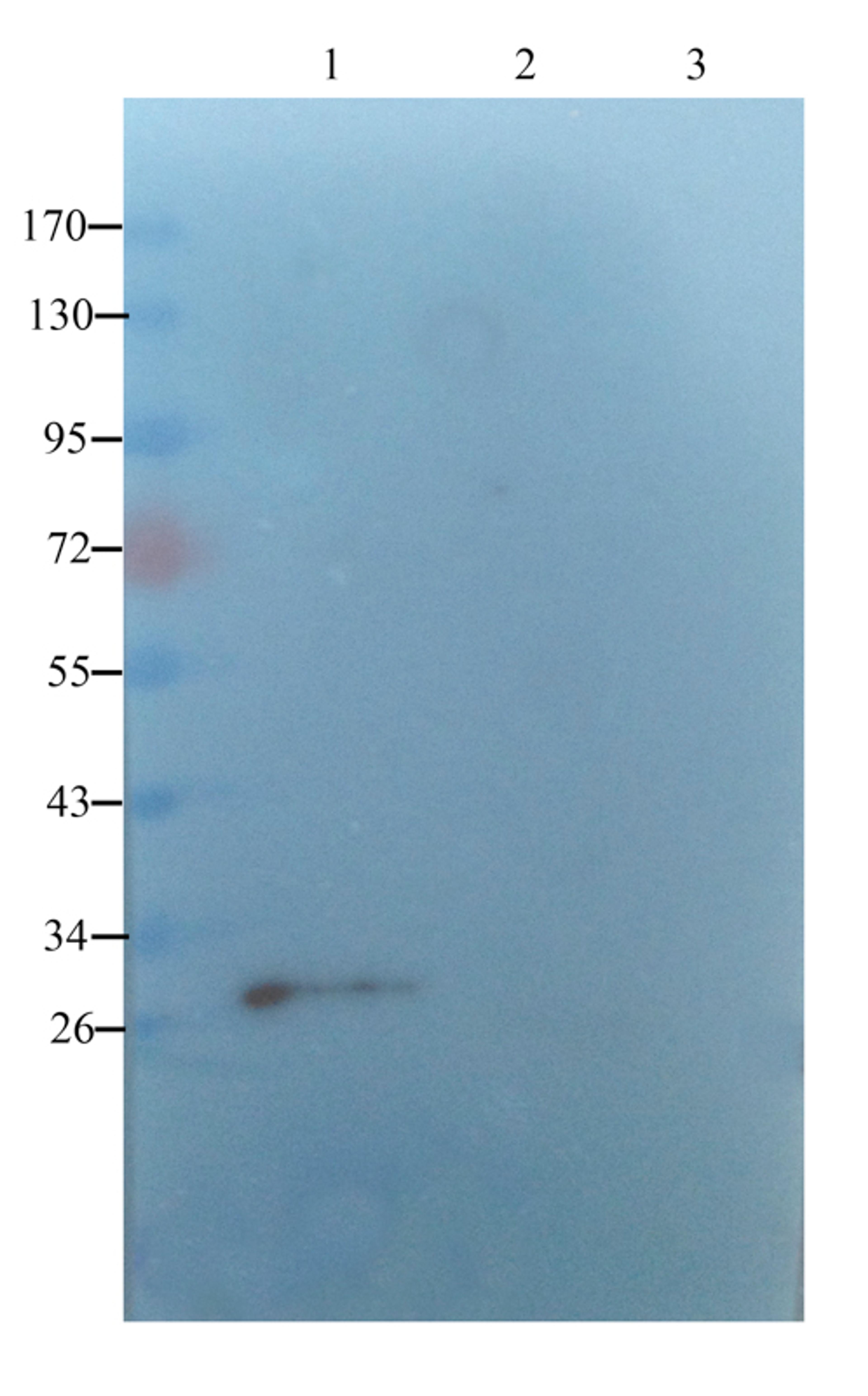 WB analysis of rar uterus (lane 1),rat ovary (lane 2),rat thyriod (lane 3) using SERPING1 antibody (1 ug/ml)