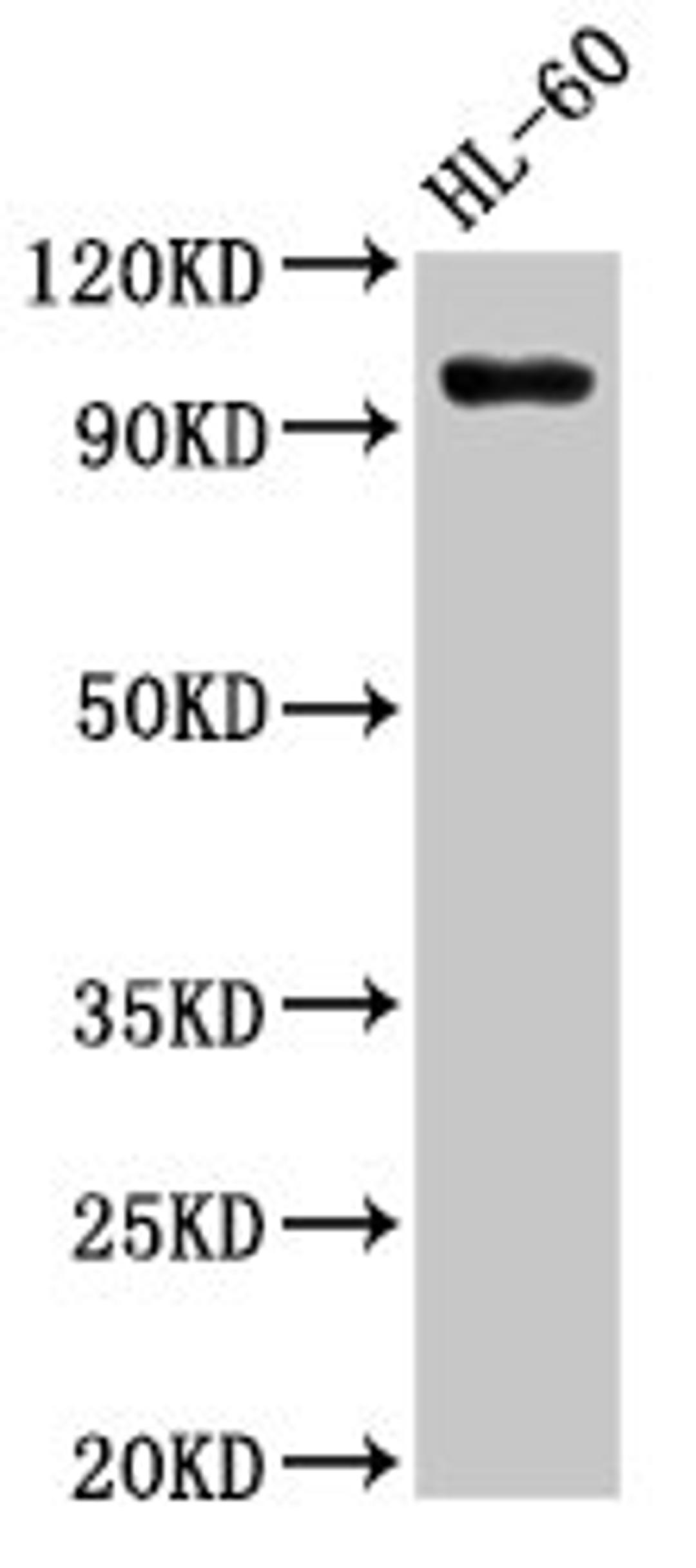 Western Blot. Positive WB detected in: HL60 whole cell lysate. All lanes: KMT5B antibody at 3µg/ml. Secondary. Goat polyclonal to rabbit IgG at 1/50000 dilution. Predicted band size: 100, 45, 32 kDa. Observed band size: 100 kDa