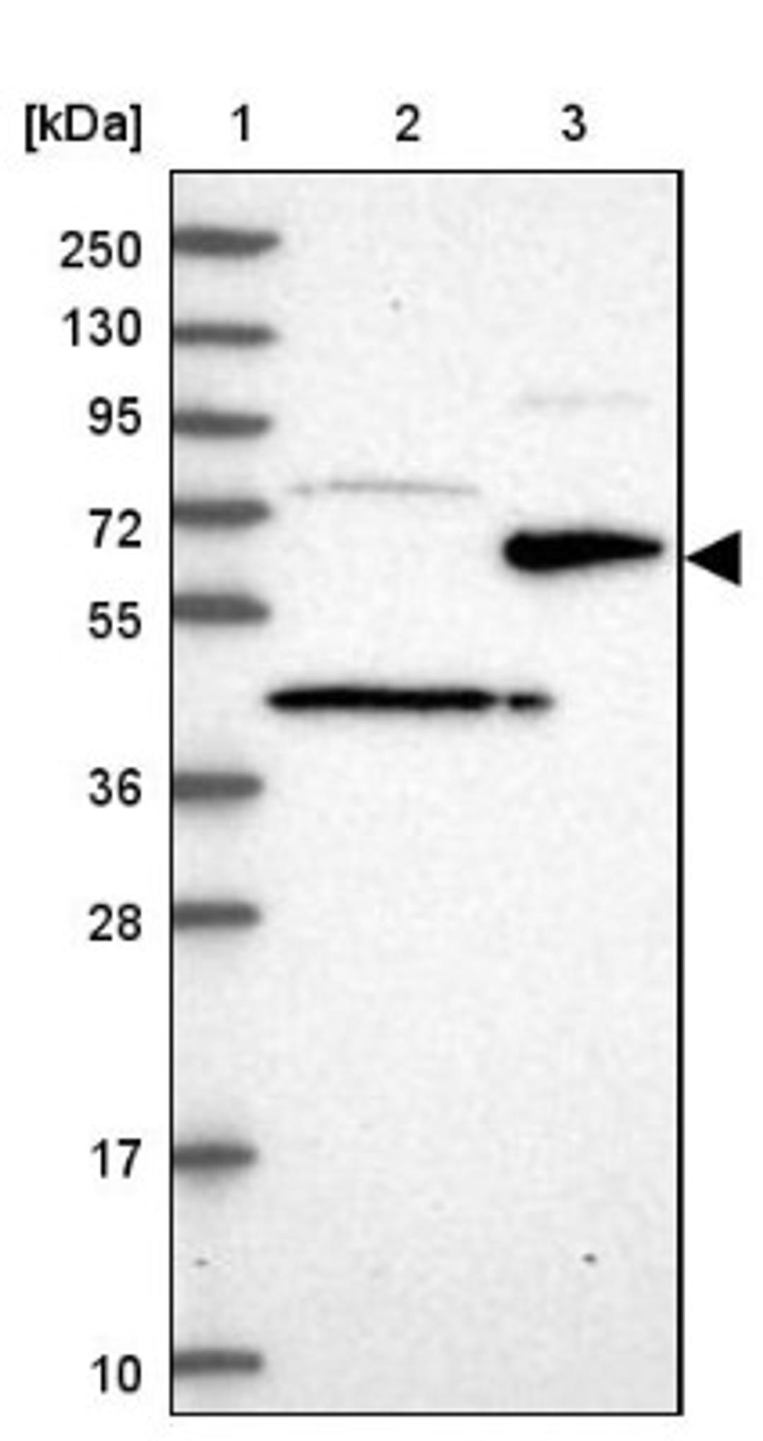 Western Blot: ST7 Antibody [NBP1-84771] - Lane 1: Marker [kDa] 250, 130, 95, 72, 55, 36, 28, 17, 10<br/>Lane 2: Human cell line RT-4<br/>Lane 3: Human cell line U-251MG sp