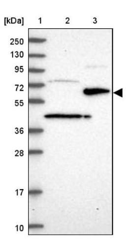 Western Blot: ST7 Antibody [NBP1-84771] - Lane 1: Marker [kDa] 250, 130, 95, 72, 55, 36, 28, 17, 10<br/>Lane 2: Human cell line RT-4<br/>Lane 3: Human cell line U-251MG sp