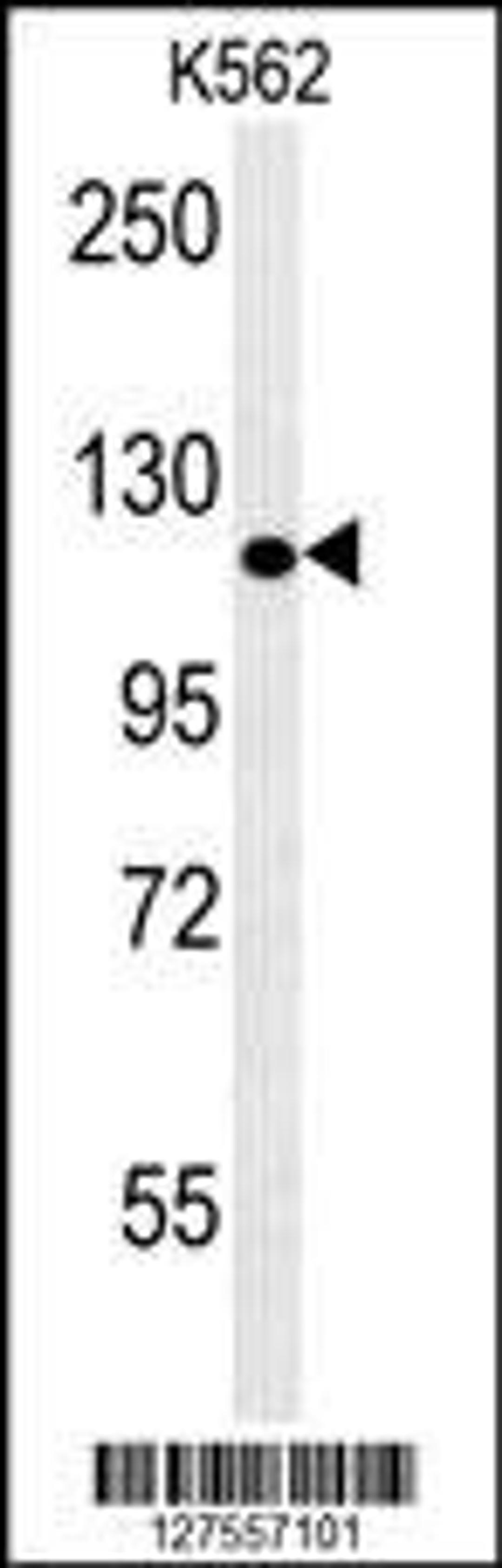 Western blot analysis of K562 cell line lysates using POTEE antibody