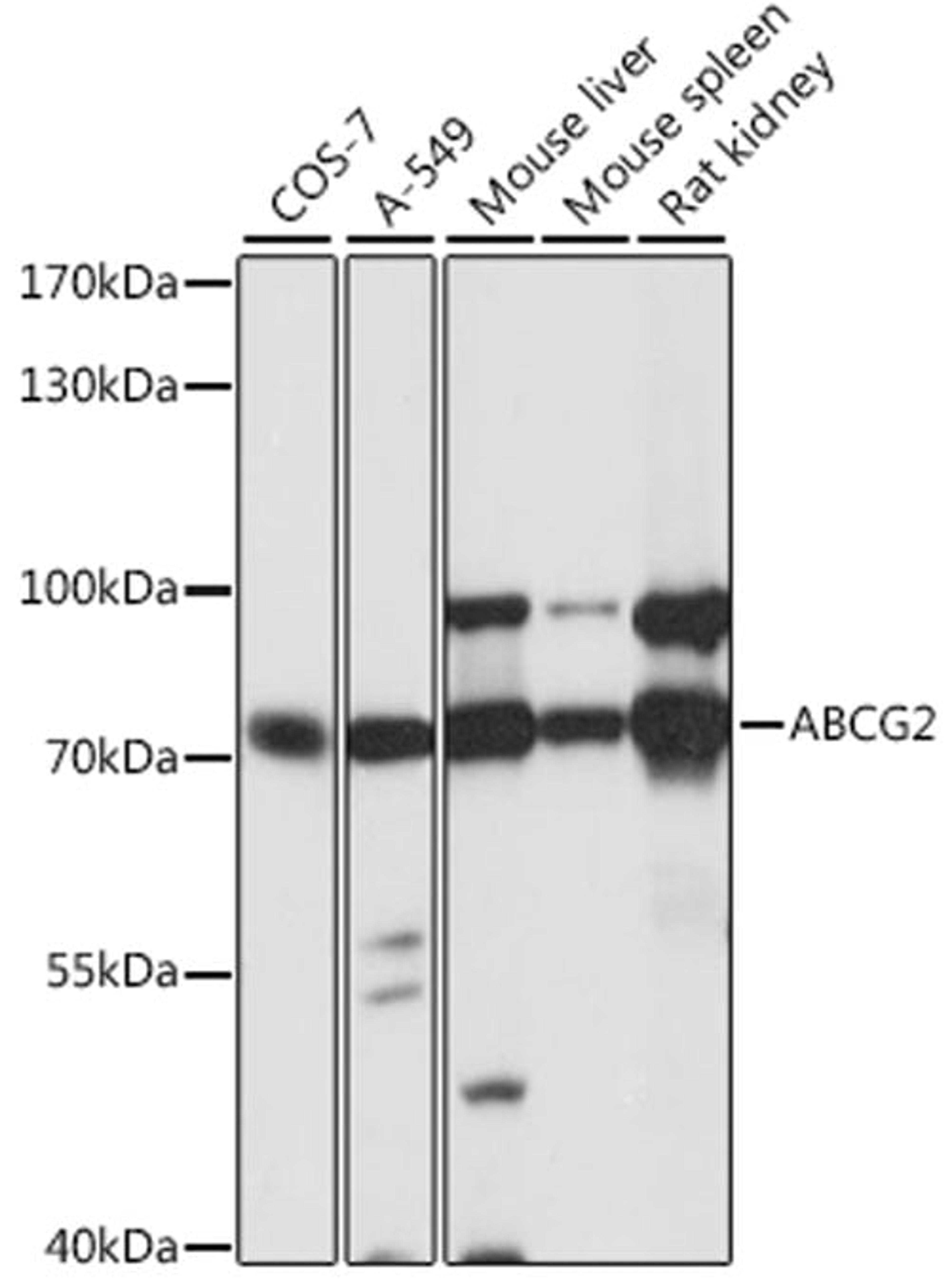 Western blot - ABCG2 antibody (A5661)