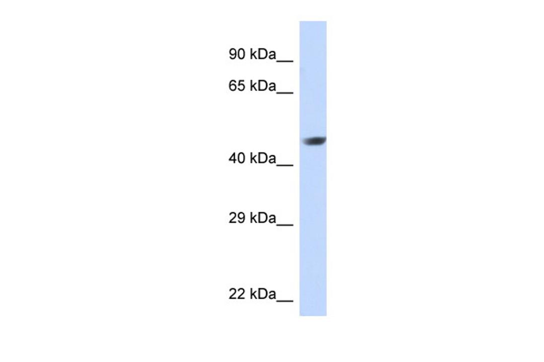 Antibody used in WB on Human Jurkat 0.03 ug/ml.