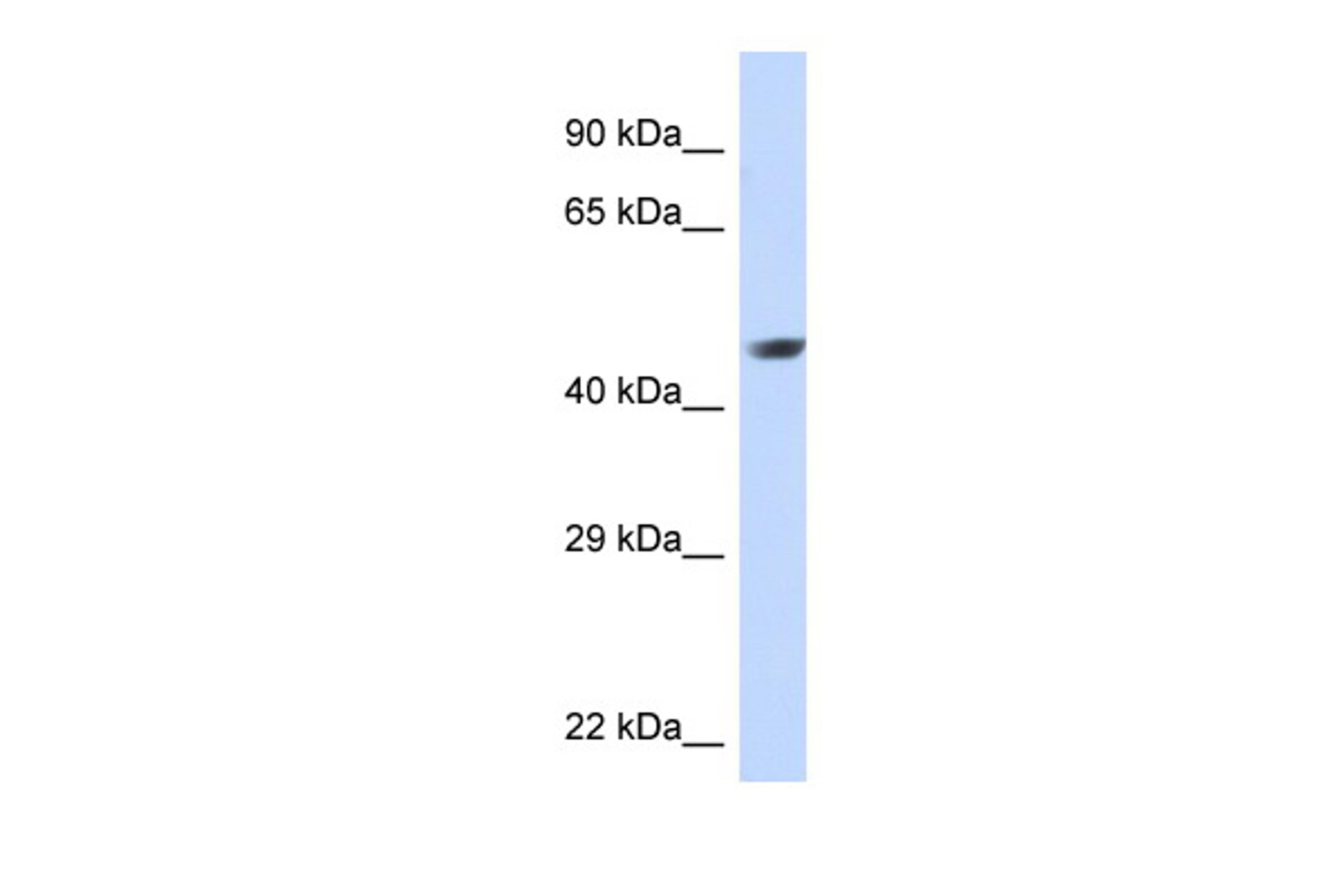 Antibody used in WB on Human Jurkat 0.03 ug/ml.