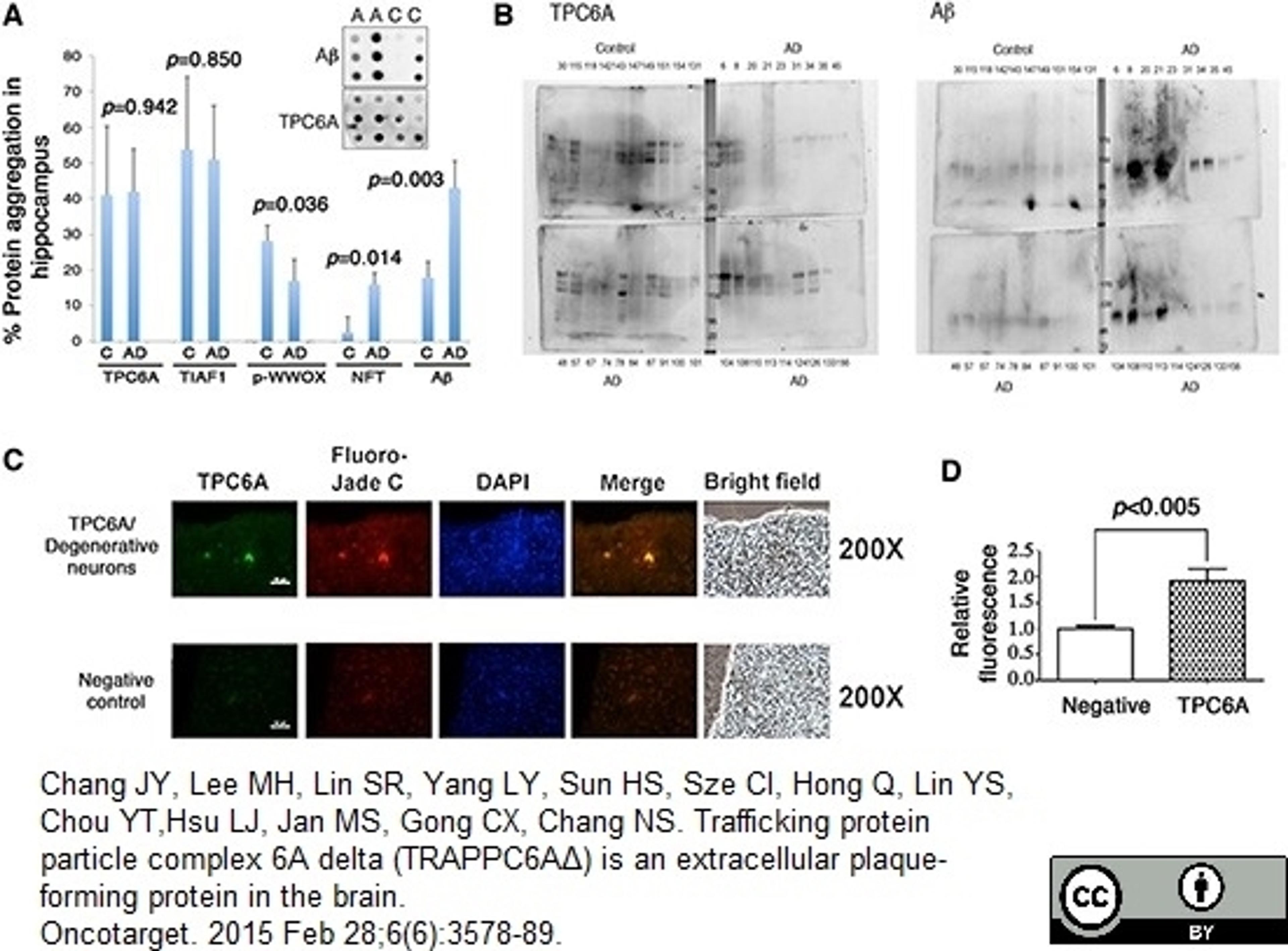 Mouse anti Human beta amyloid used for the evaluation of amyloid deposition