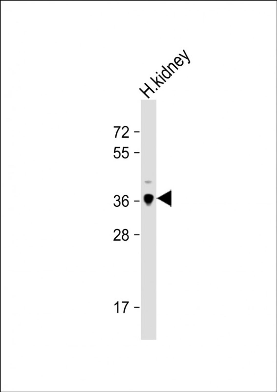 Western Blot at 1:1000 dilution + human kidney lysate Lysates/proteins at 20 ug per lane.