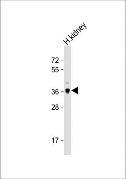 Western Blot at 1:1000 dilution + human kidney lysate Lysates/proteins at 20 ug per lane.