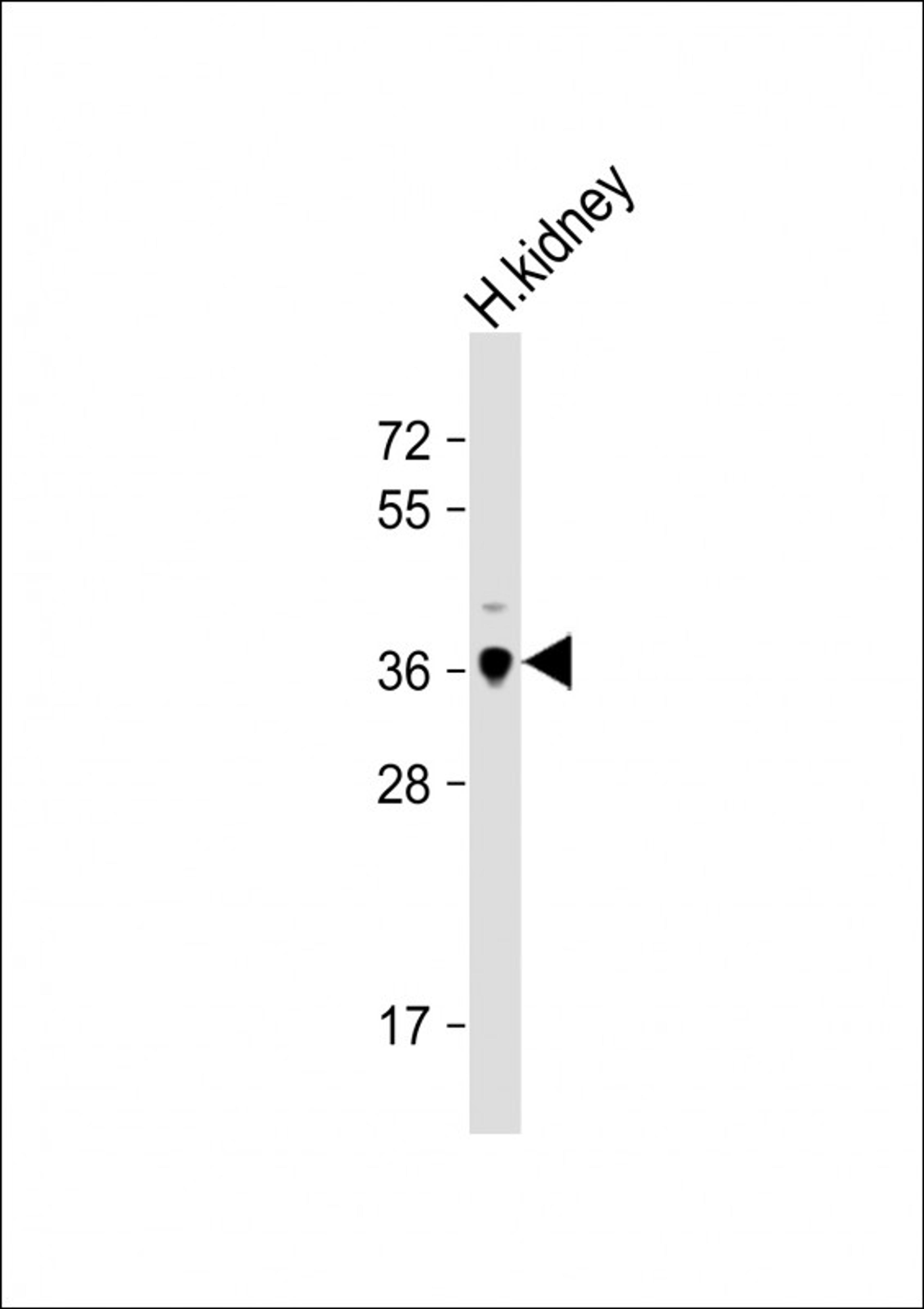 Western Blot at 1:1000 dilution + human kidney lysate Lysates/proteins at 20 ug per lane.