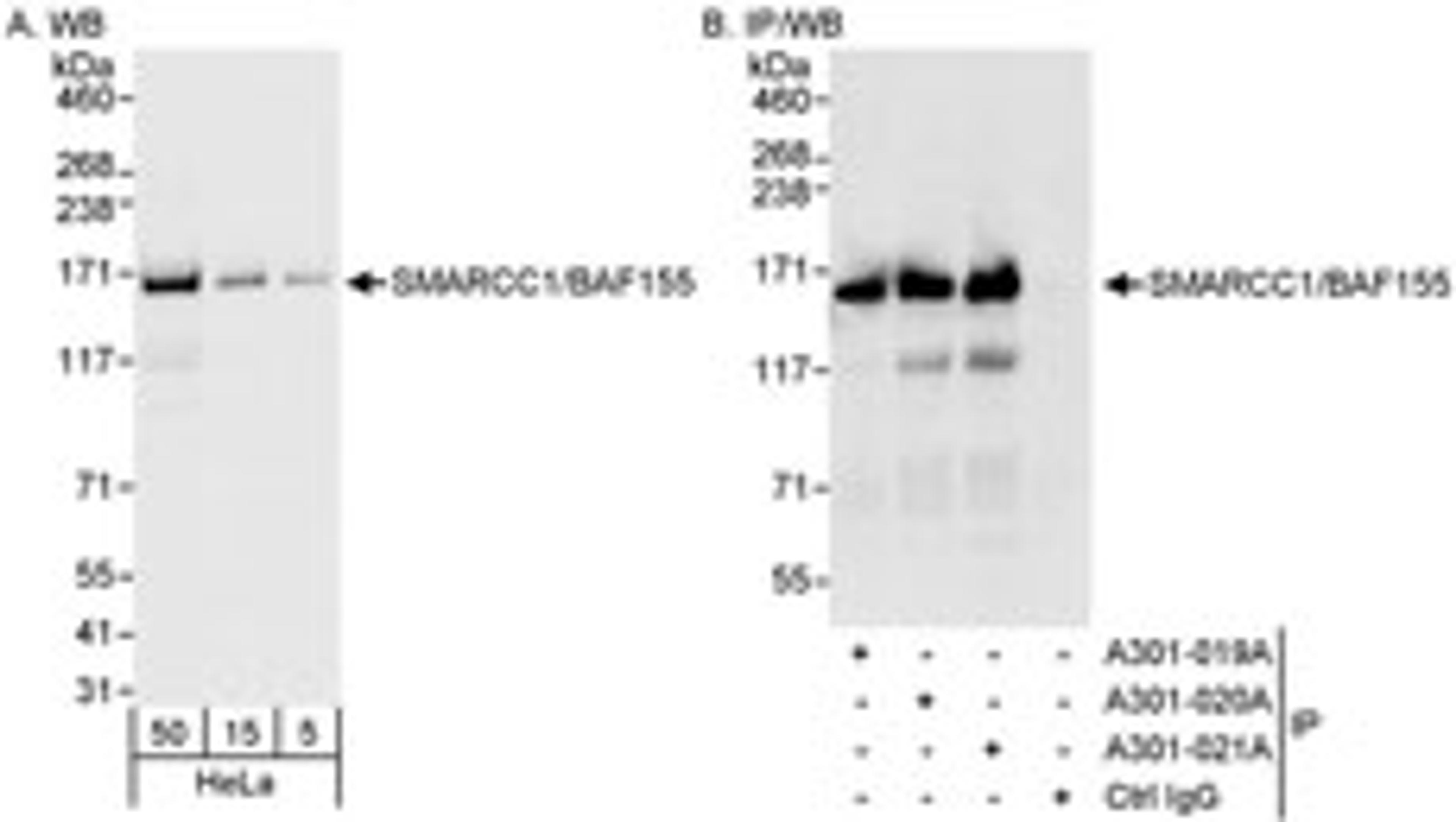 Detection of human SMARCC1/BAF155 by western blot and immunoprecipitation.