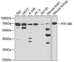 Western blot - P70 S6K antibody (A2190)