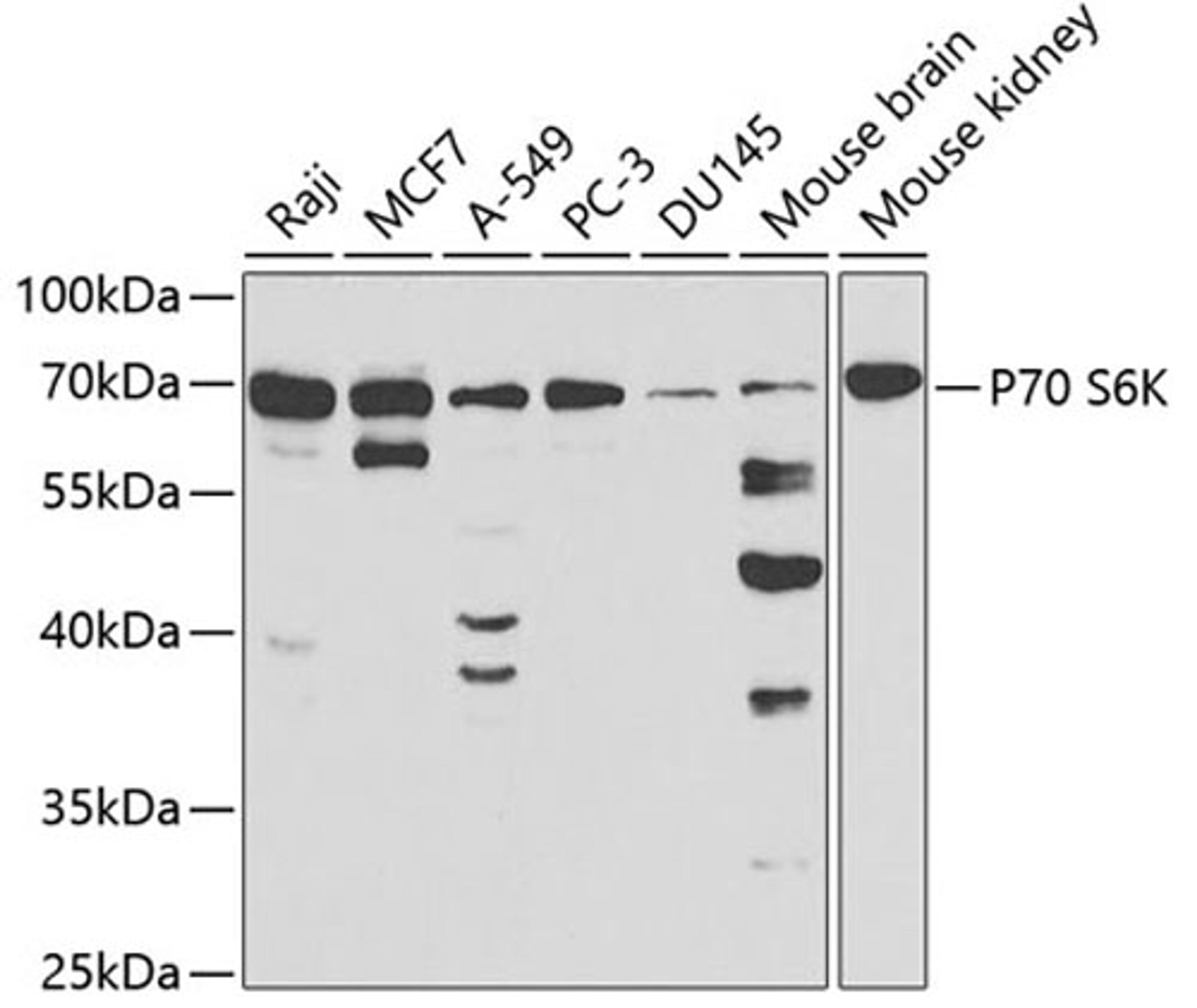 Western blot - P70 S6K antibody (A2190)