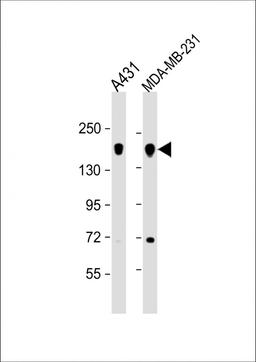 Western Blot at 1:1000 dilution Lane 1: A431 whole cell lysate Lane 2: MDA-MB-231 whole cell lysate Lysates/proteins at 20 ug per lane.