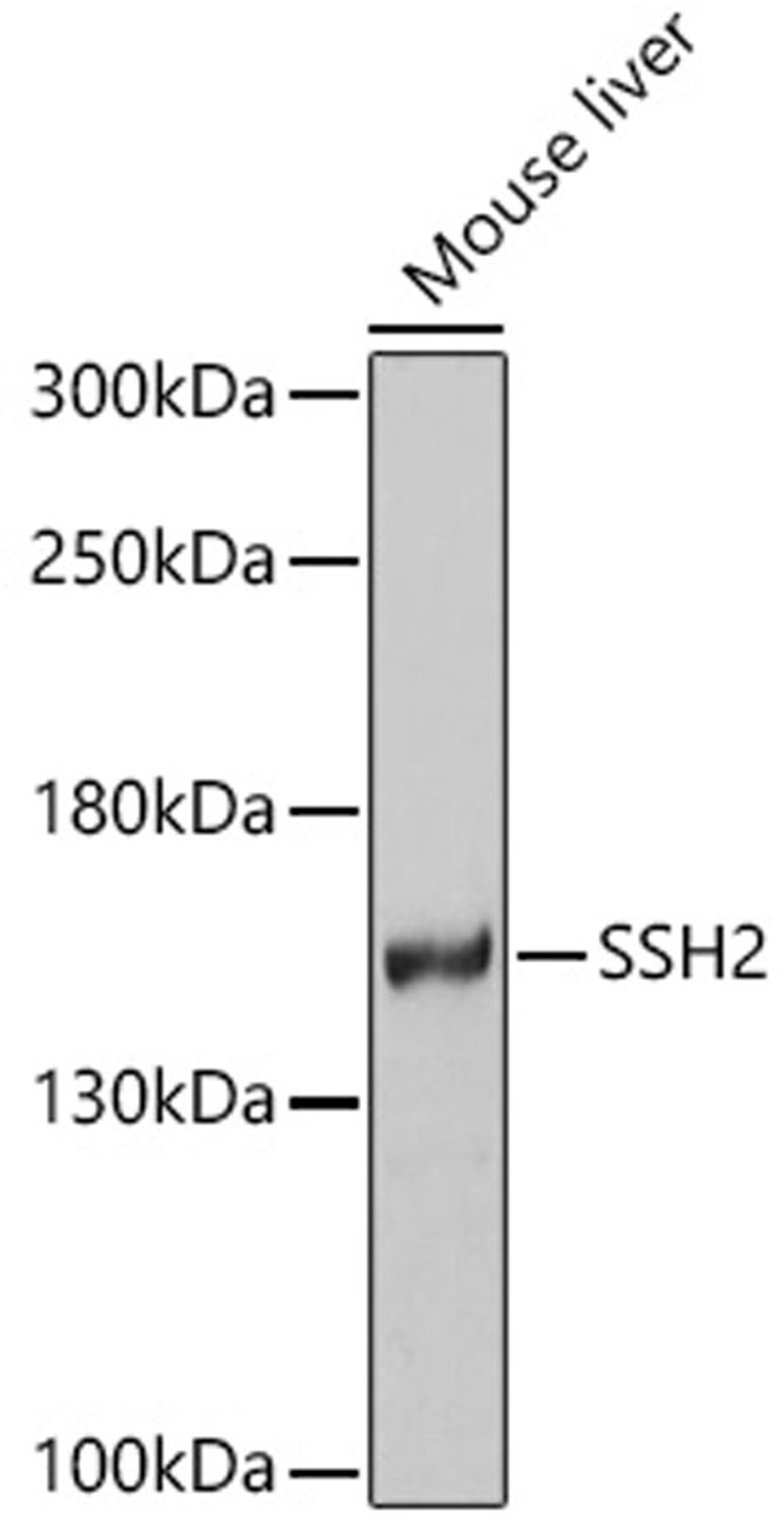 Western blot - SSH2 antibody (A9988)