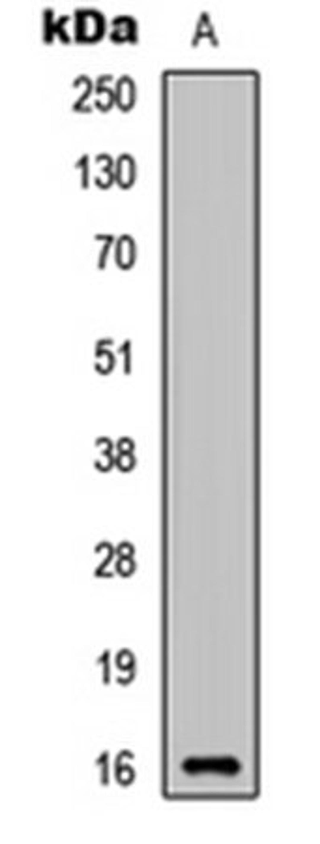 Western blot analysis of SHSY5Y (Lane 1) whole cell lysates using C17 antibody