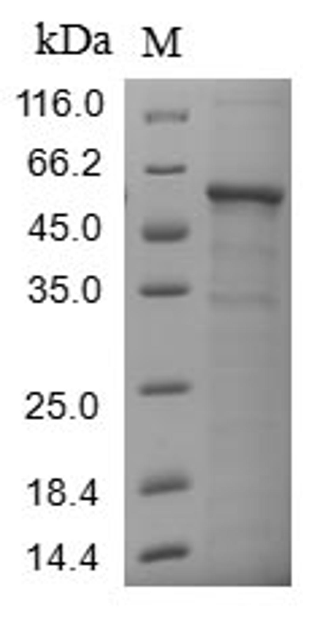 (Tris-Glycine gel) Discontinuous SDS-PAGE (reduced) with 5% enrichment gel and 15% separation gel.