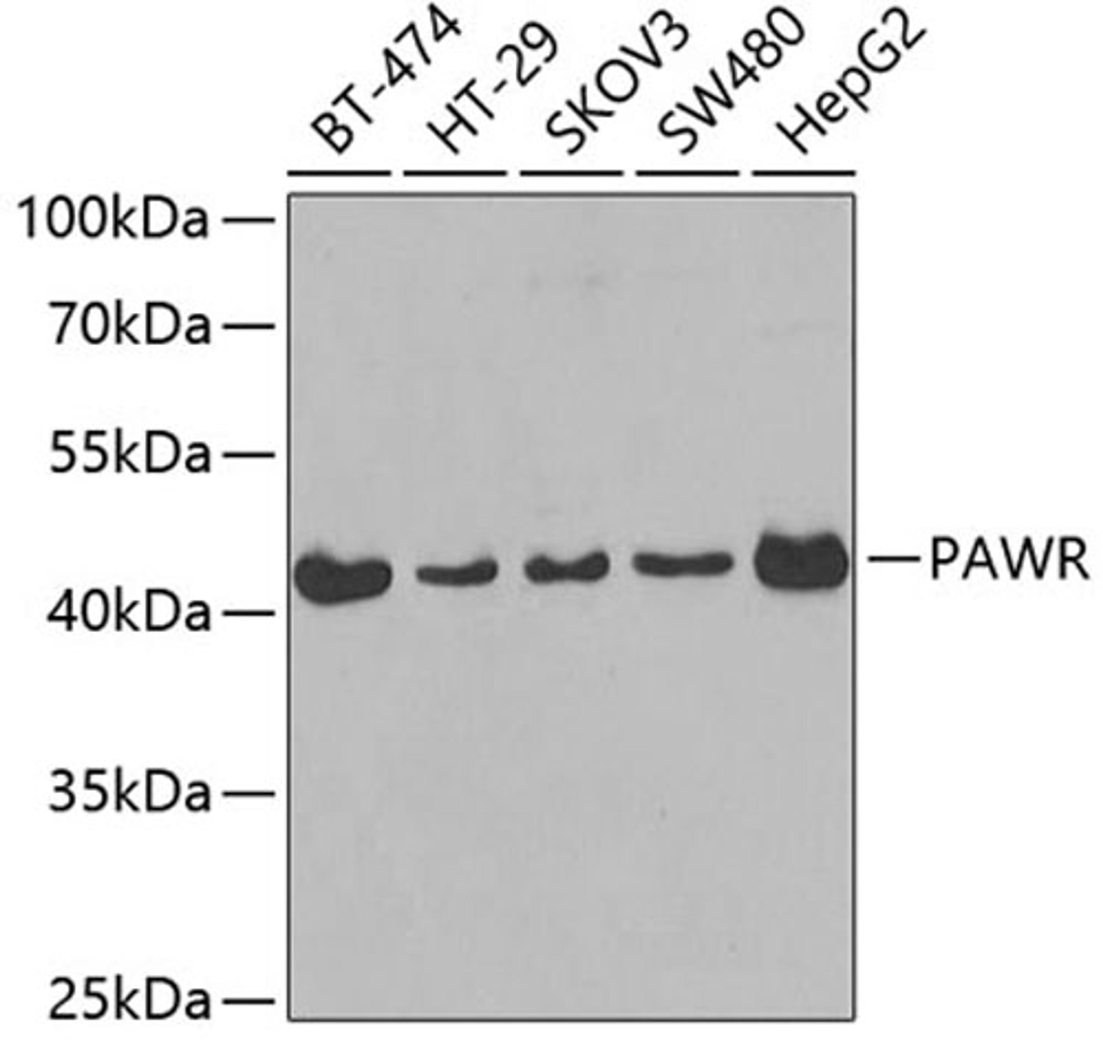 Western blot - PAWR antibody (A3063)