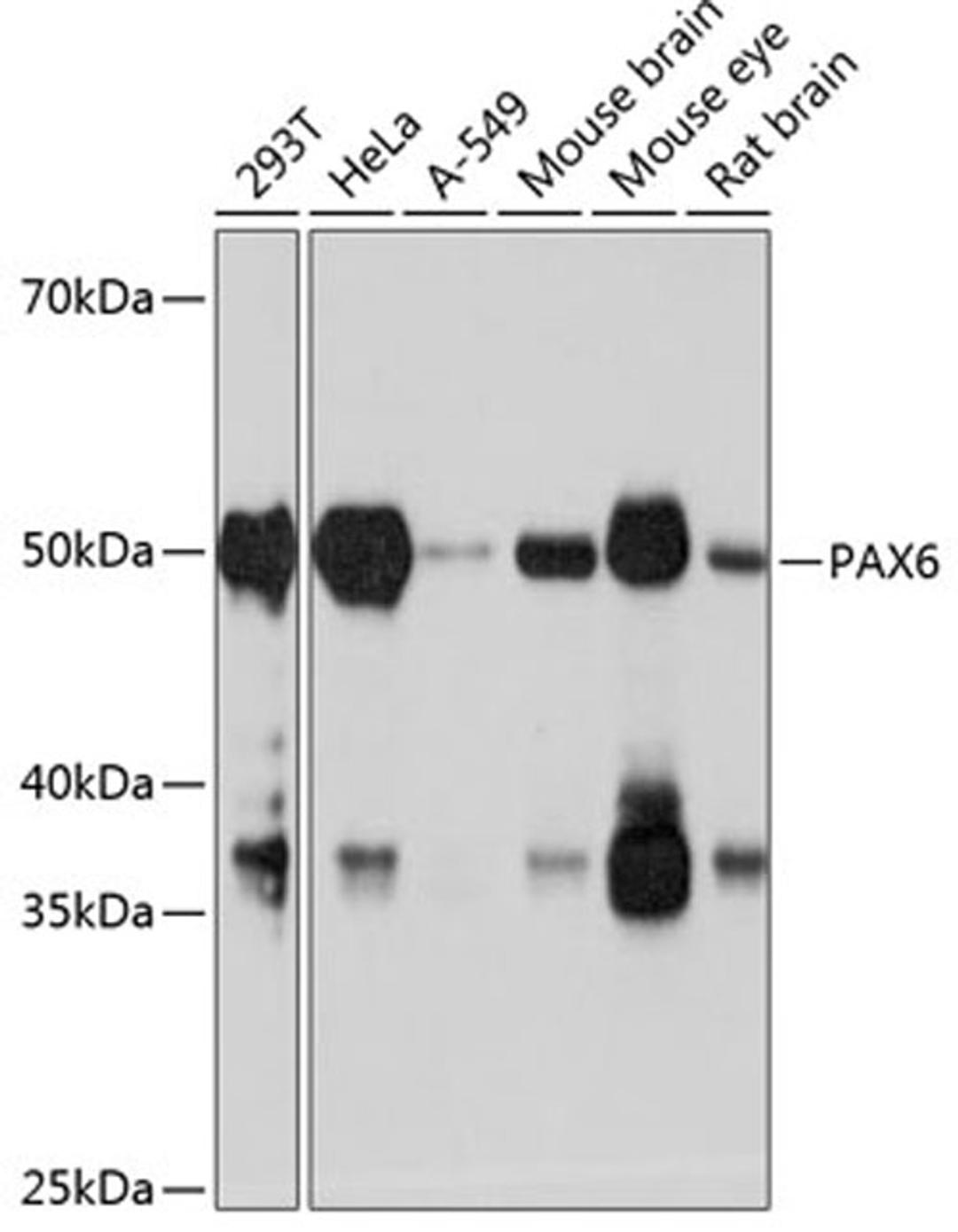 Western blot - PAX6 antibody (A19099)