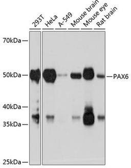 Western blot - PAX6 antibody (A19099)