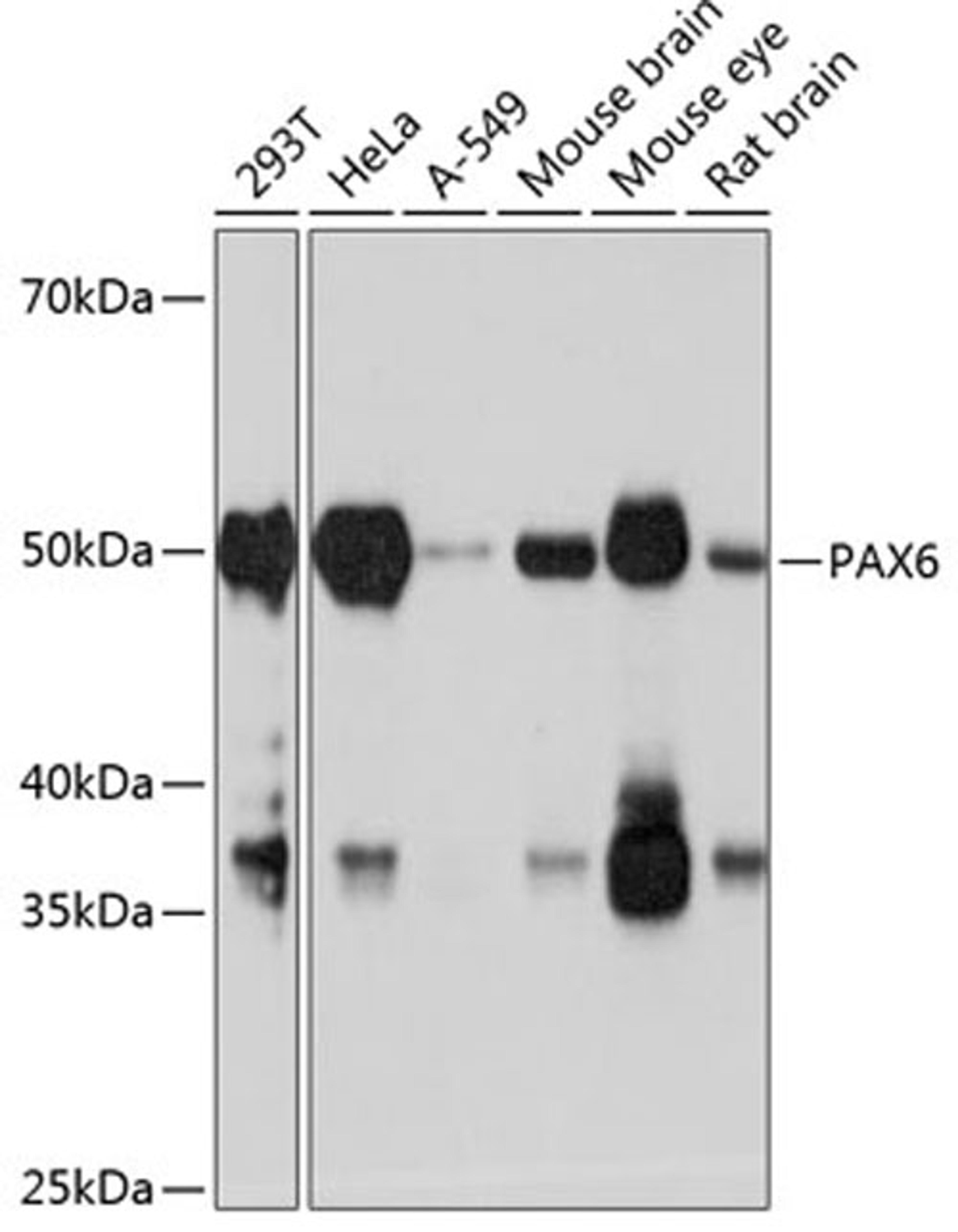 Western blot - PAX6 antibody (A19099)