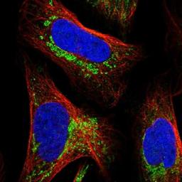 Immunocytochemistry/Immunofluorescence: C7orf30 Antibody [NBP1-86026] - Staining of human cell line U-2 OS shows positivity in mitochondria.