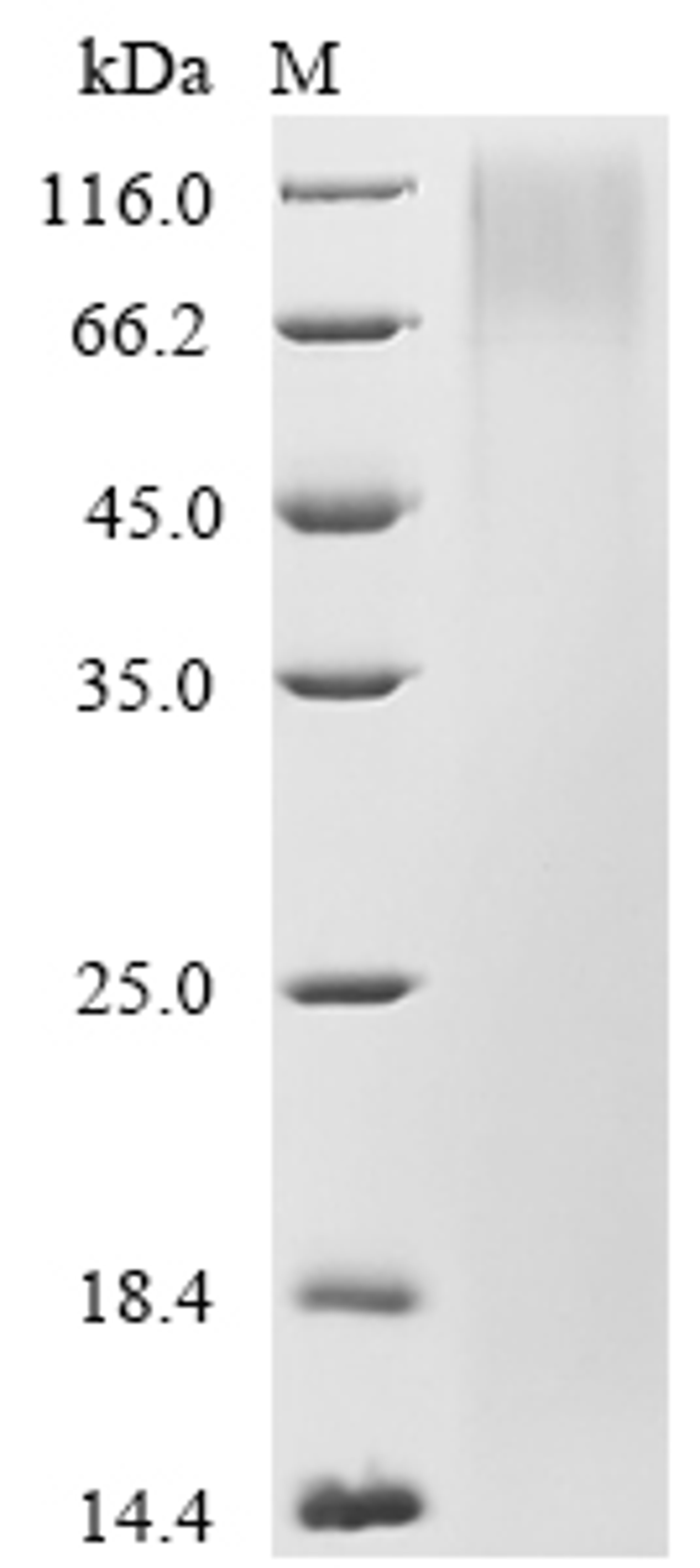 (Tris-Glycine gel) Discontinuous SDS-PAGE (reduced) with 5% enrichment gel and 15% separation gel.