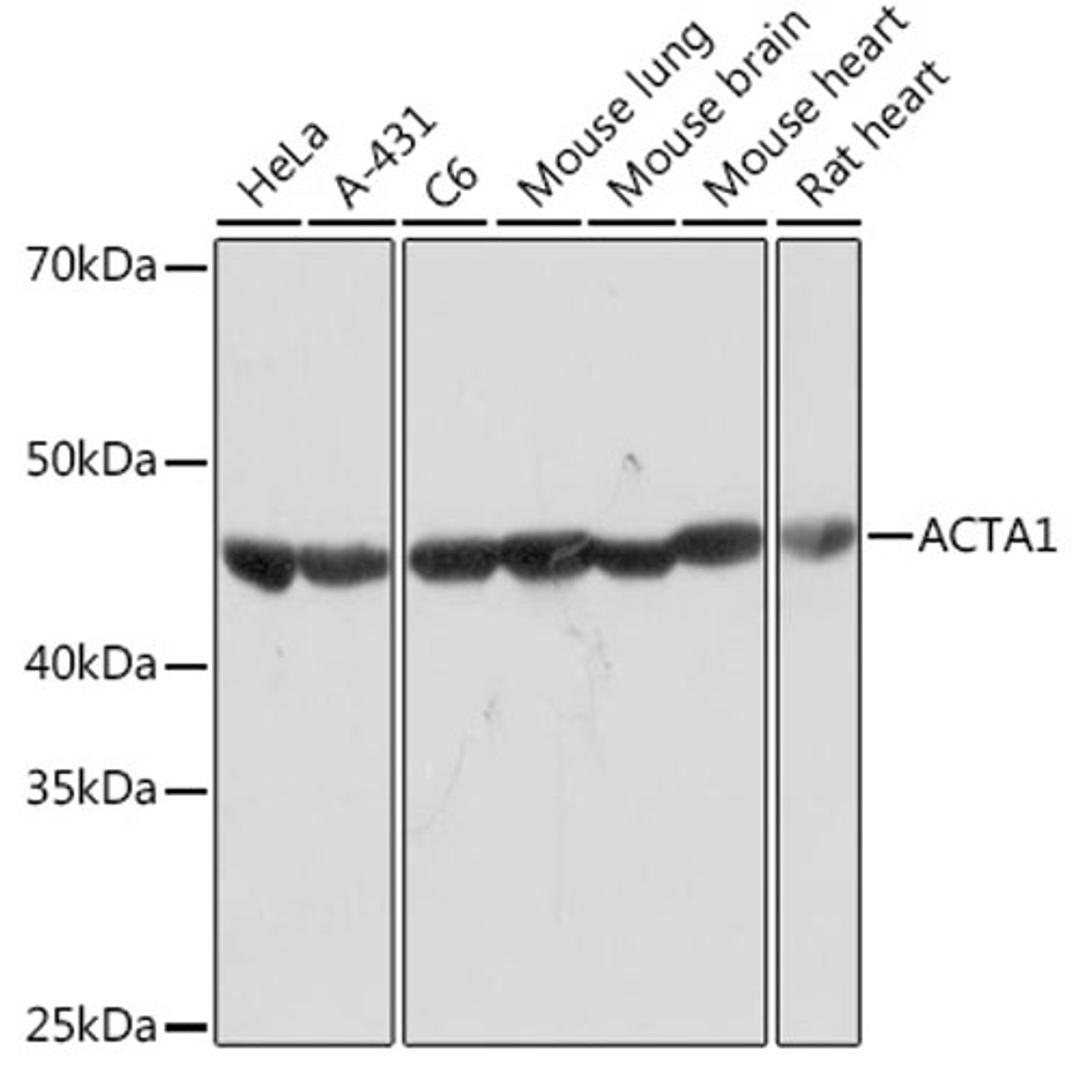 Western blot - ACTA1 Rabbit mAb (A2280)