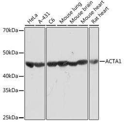 Western blot - ACTA1 Rabbit mAb (A2280)