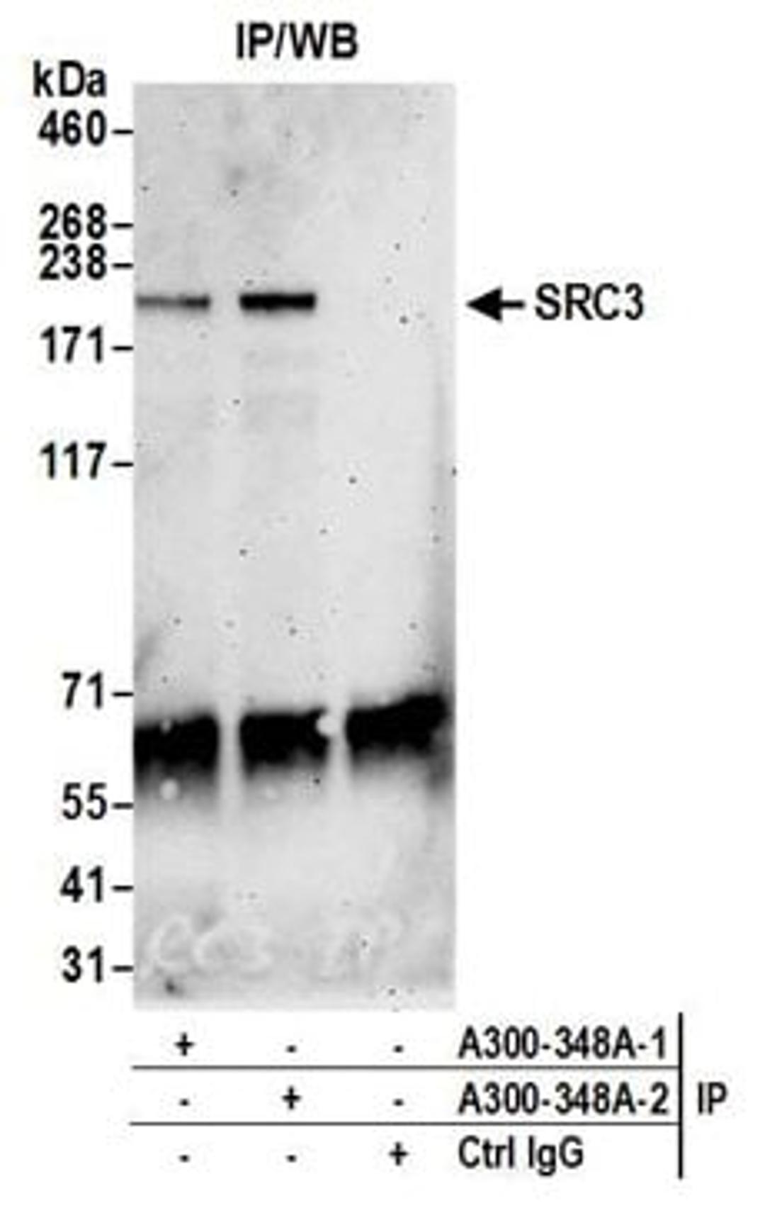 Detection of human SRC3 by western blot of immunoprecipitates.