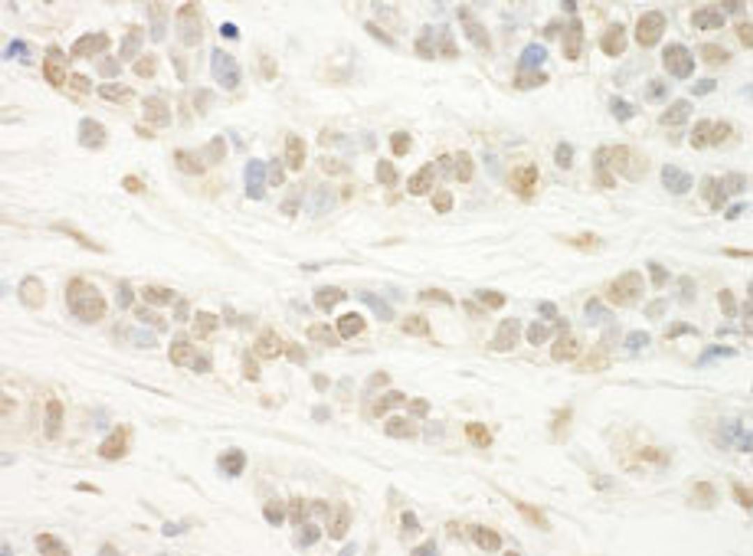 Detection of human WDR5 by immunohistochemistry.