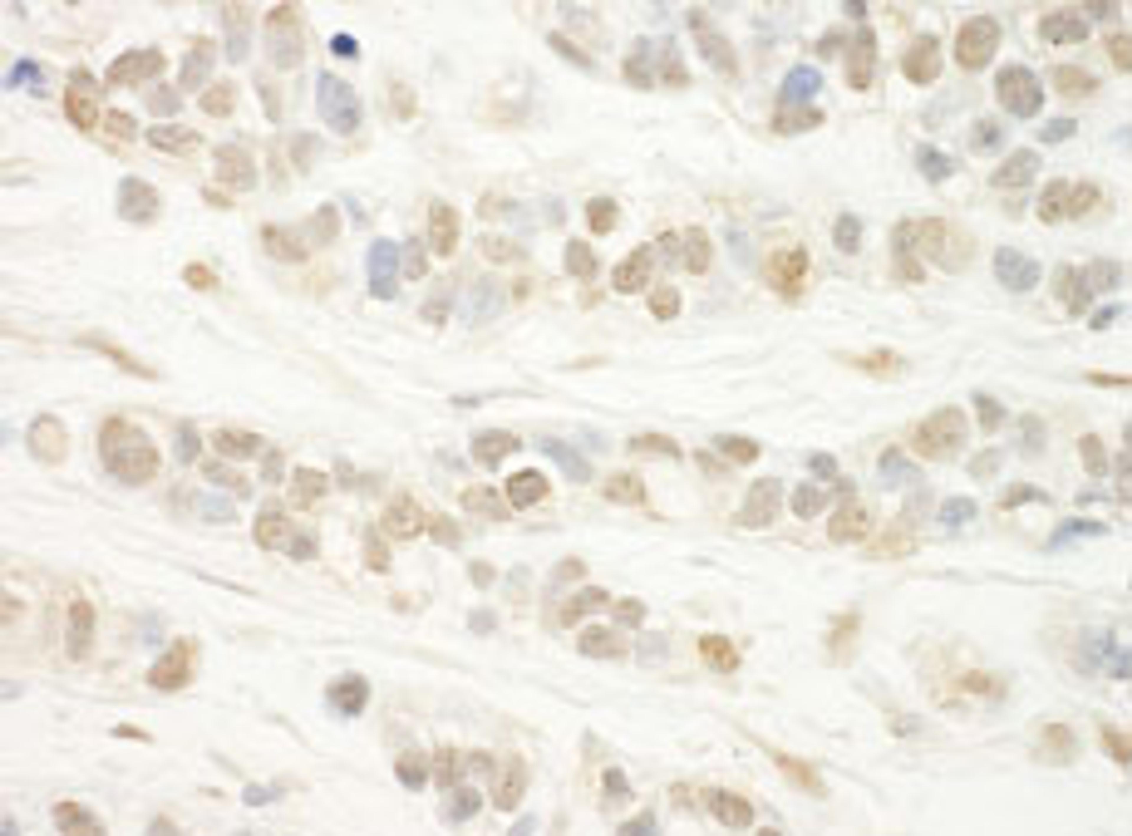 Detection of human WDR5 by immunohistochemistry.