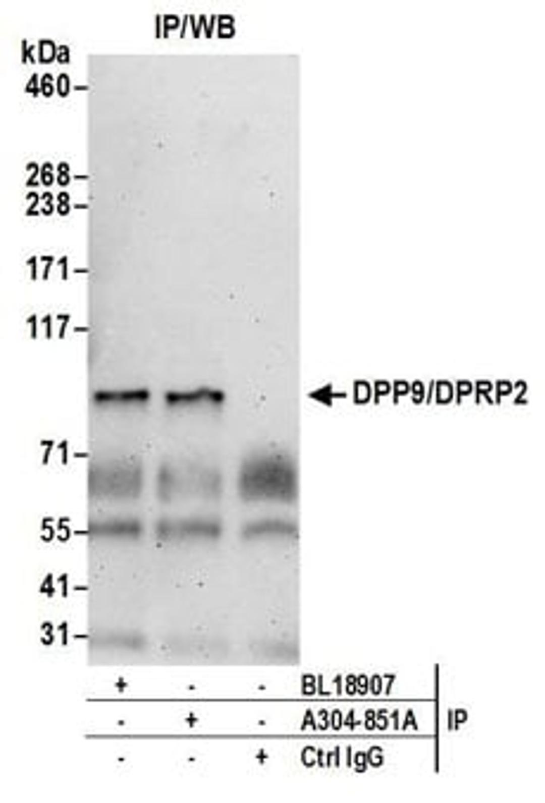 Detection of human DPP9/DPRP2 by western blot of immunoprecipitates.