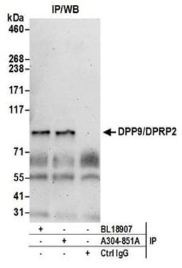 Detection of human DPP9/DPRP2 by western blot of immunoprecipitates.