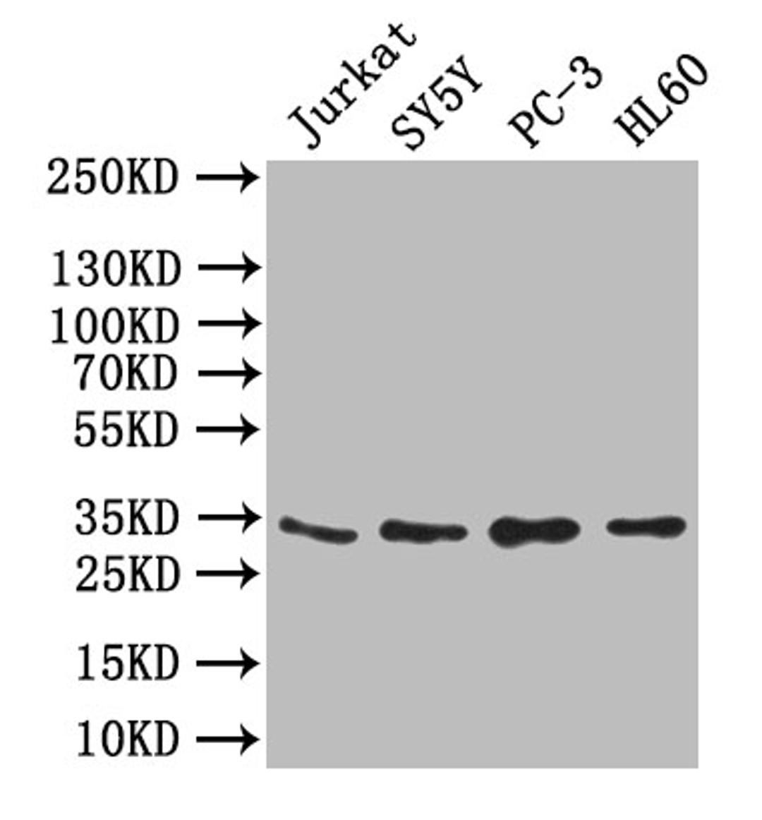Western Blot. Positive WB detected in: JK whole cell lysate,SY5Y whole cell lysate,PC-3 whole cell lysate,,HL60 whole cell lysate. All lanes: UCP1 antibody at 1:1000. Secondary. Goat polyclonal to rabbit IgG at 1/50000 dilution. Predicted band size: 33 kDa. Observed band size: 33 kDa. 