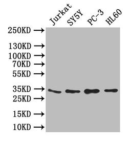 Western Blot. Positive WB detected in: JK whole cell lysate,SY5Y whole cell lysate,PC-3 whole cell lysate,,HL60 whole cell lysate. All lanes: UCP1 antibody at 1:1000. Secondary. Goat polyclonal to rabbit IgG at 1/50000 dilution. Predicted band size: 33 kDa. Observed band size: 33 kDa. 