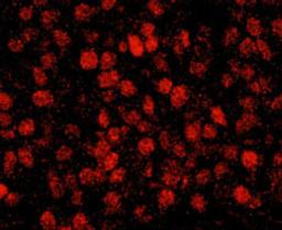 Detection of human RCOR3 by immunohistochemistry.