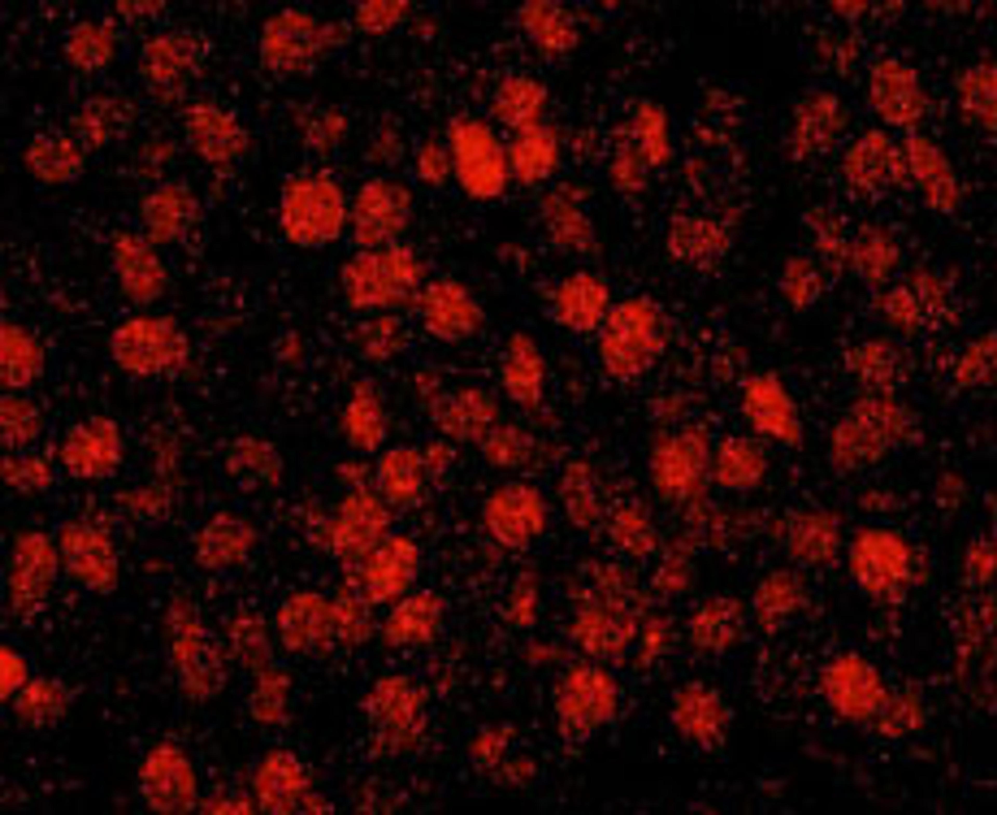 Detection of human RCOR3 by immunohistochemistry.