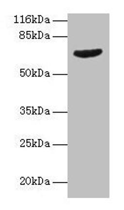 Western blot. All lanes: GRK4 antibody at 2µg/ml + Jurkat whole cell lysate. Secondary. Goat polyclonal to rabbit IgG at 1/10000 dilution. Predicted band size: 67, 64, 58, 62 kDa. Observed band size: 67 kDa