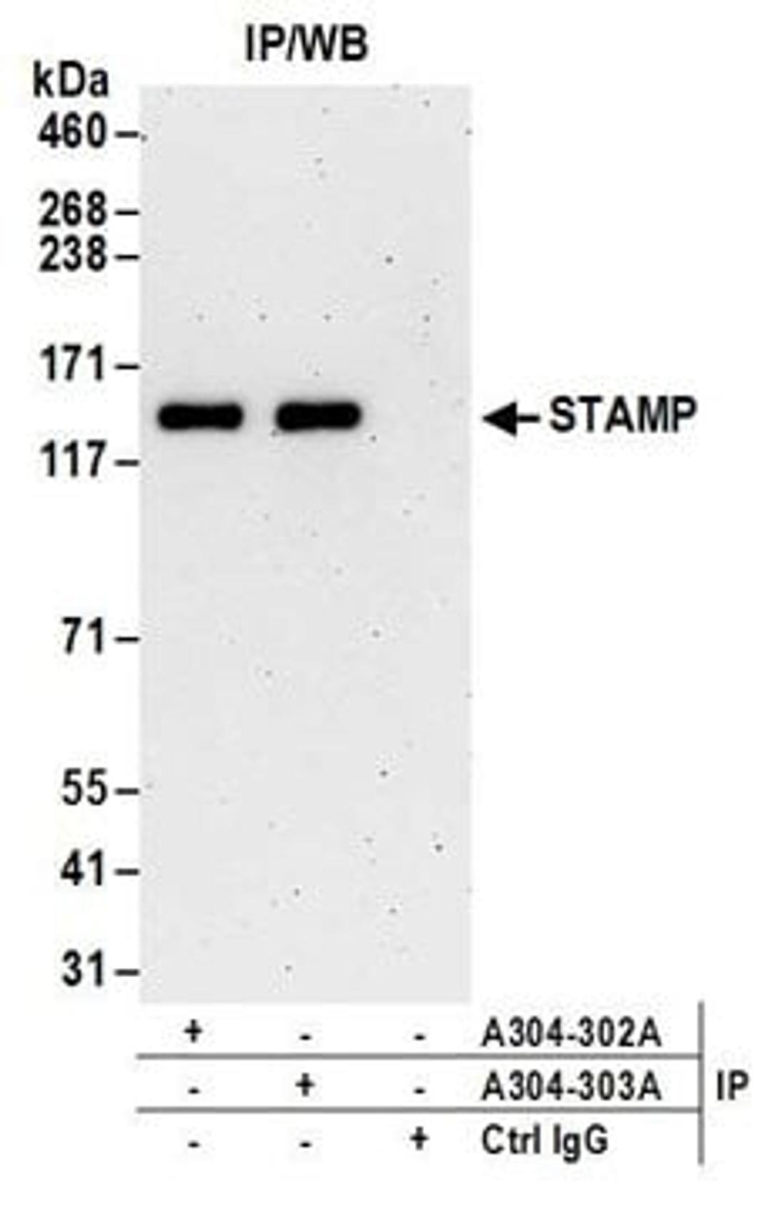 Detection of human STAMP by western blot of immunoprecipitates.