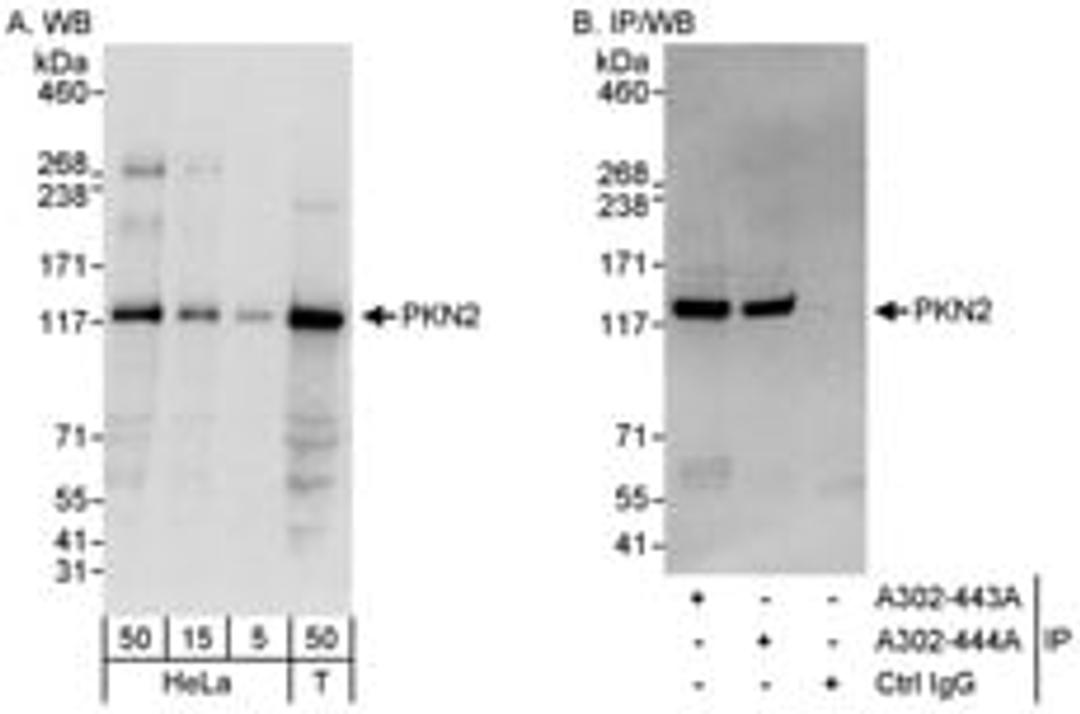 Detection of human PKN2 by western blot and immunoprecipitation.