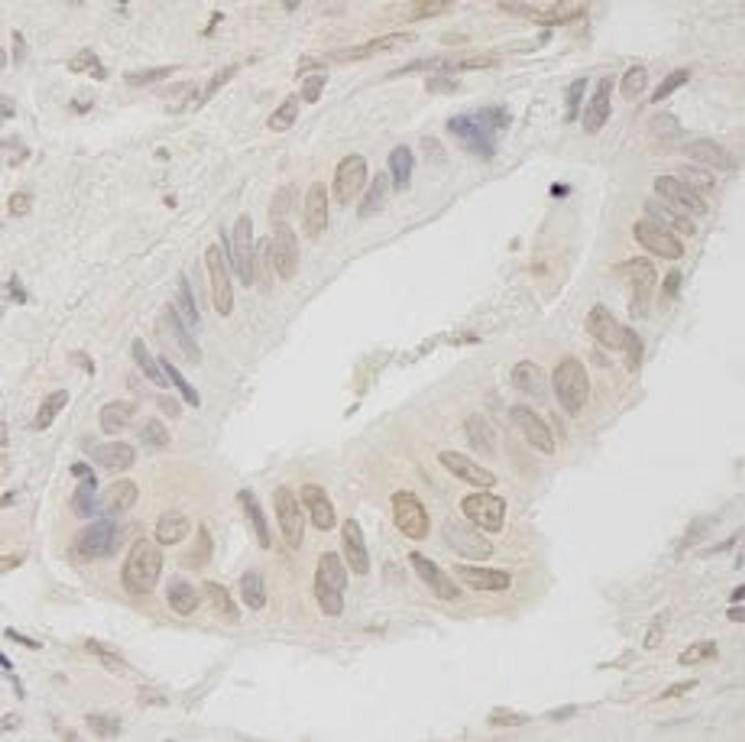 Detection of human ANKRD28/PITK immunohistochemistry.