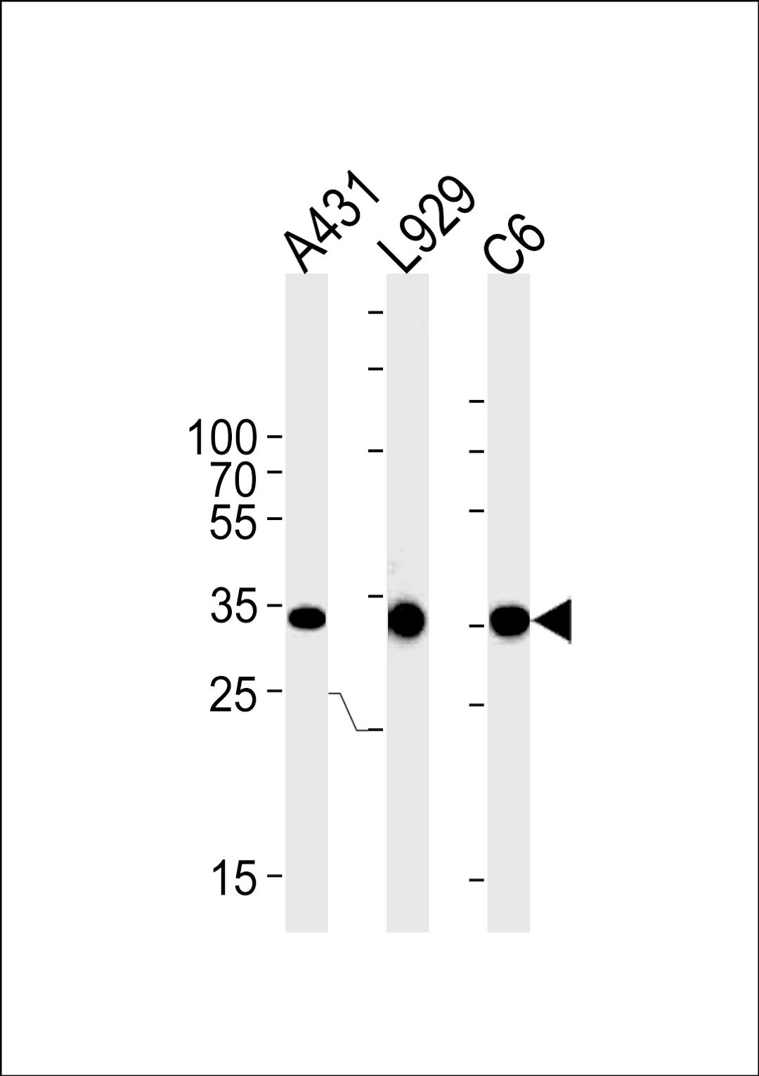 Western blot analysis in A431,mouse L929,rat C6 cell line lysates (35ug/lane).This demonstrates the CCND1 antibody detected the CCND1 protein (arrow).