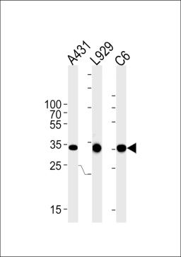 Western blot analysis in A431,mouse L929,rat C6 cell line lysates (35ug/lane).This demonstrates the CCND1 antibody detected the CCND1 protein (arrow).