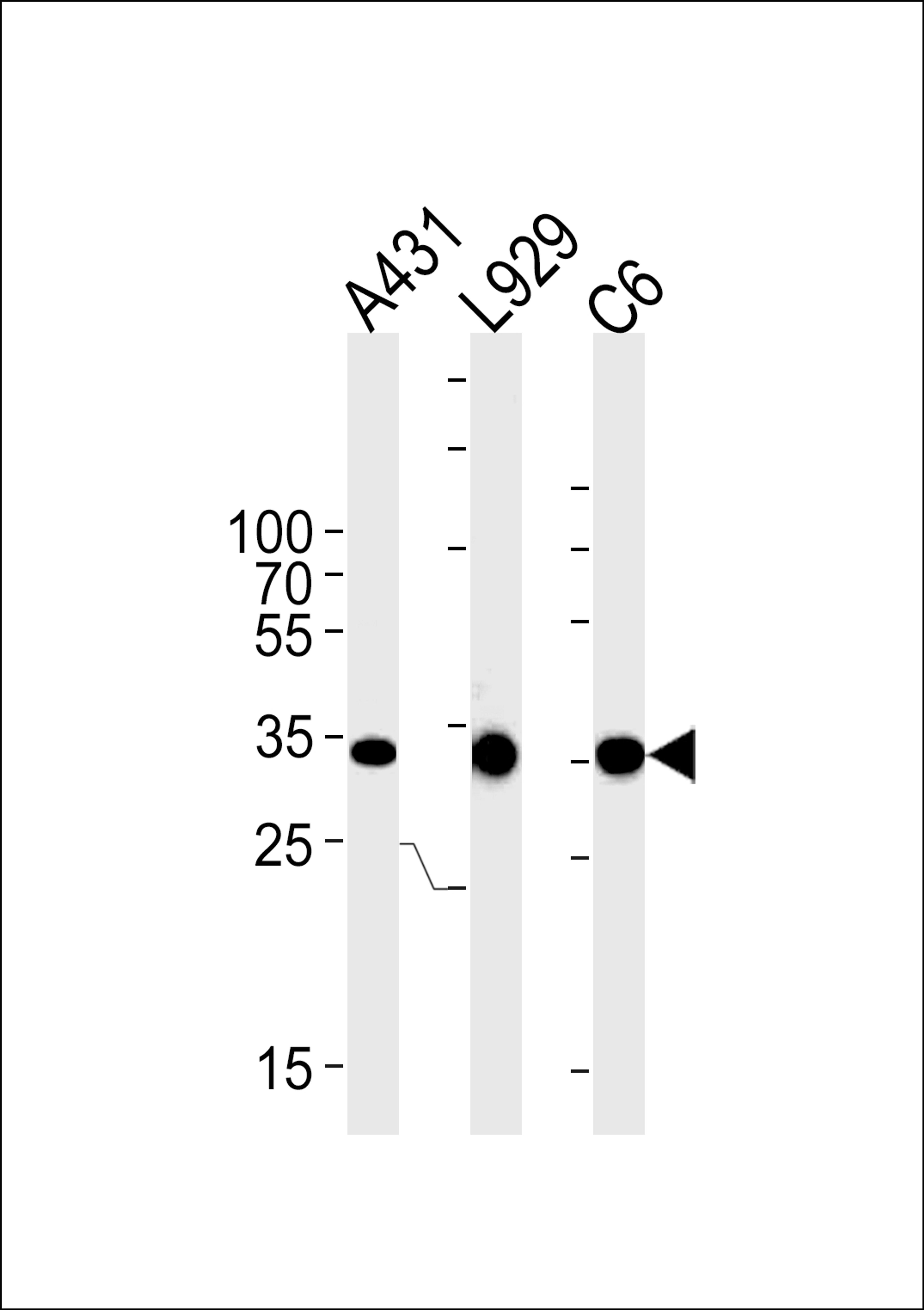 Western blot analysis in A431,mouse L929,rat C6 cell line lysates (35ug/lane).This demonstrates the CCND1 antibody detected the CCND1 protein (arrow).