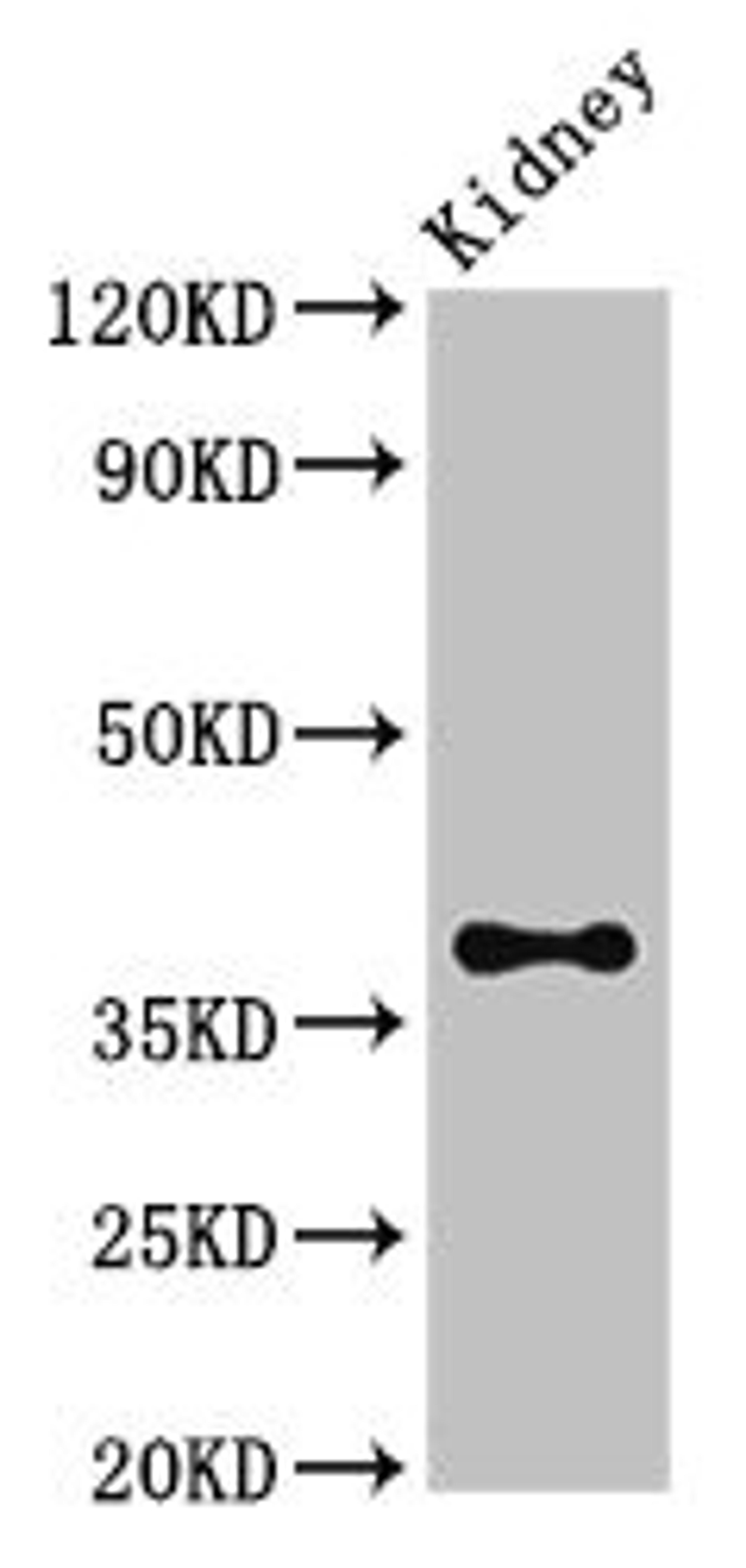Western Blot. Positive WB detected in: Mouse kidney tissue. All lanes: Atoh1 antibody at 3.4µg/ml. Secondary. Goat polyclonal to rabbit IgG at 1/50000 dilution. Predicted band size: 38 kDa. Observed band size: 38 kDa