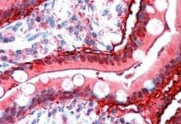 Immunohistochemistry-Paraffin: intestinal FABP Antibody [NB100-59746] - (2.5ug/ml) Staining of Human Small Intestine. Steamed antigen retrieval with citrate buffer pH 6, AP-staining.