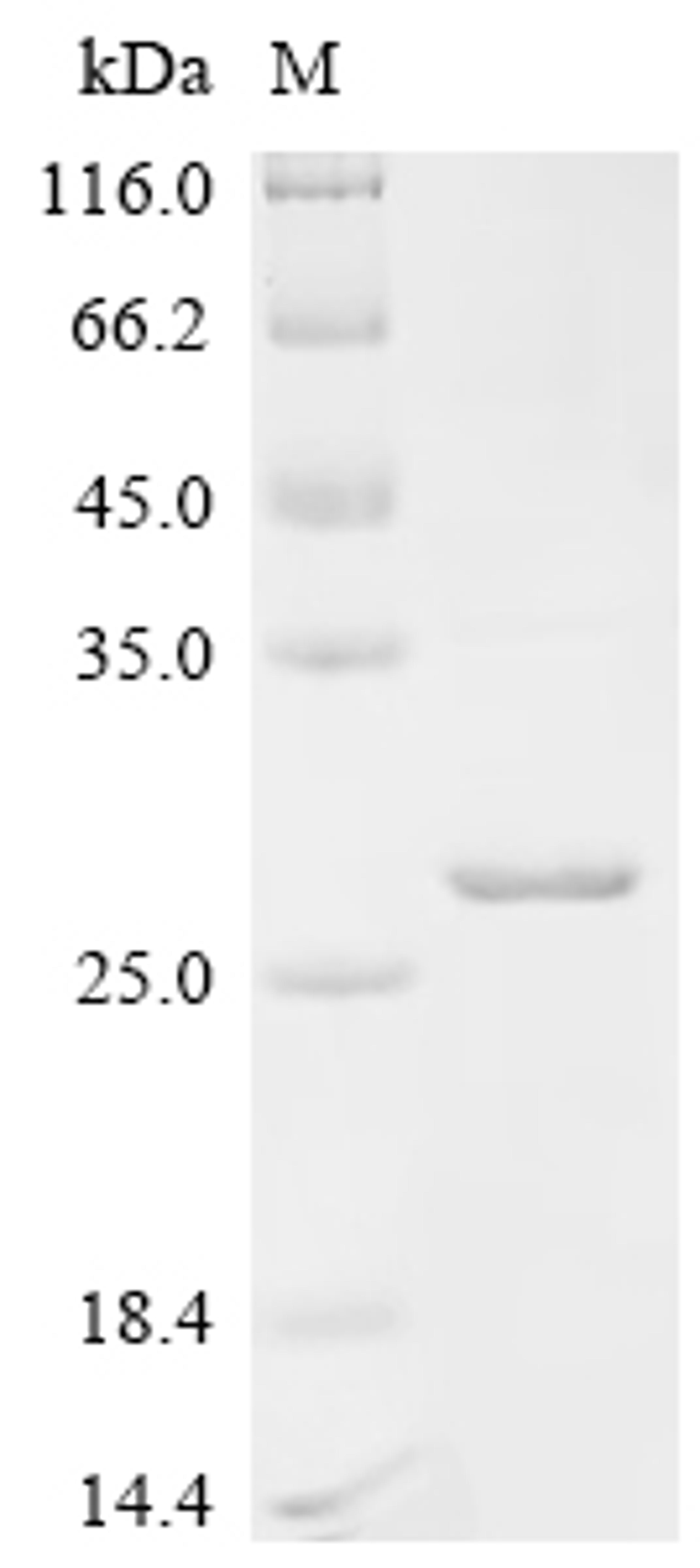 (Tris-Glycine gel) Discontinuous SDS-PAGE (reduced) with 5% enrichment gel and 15% separation gel.