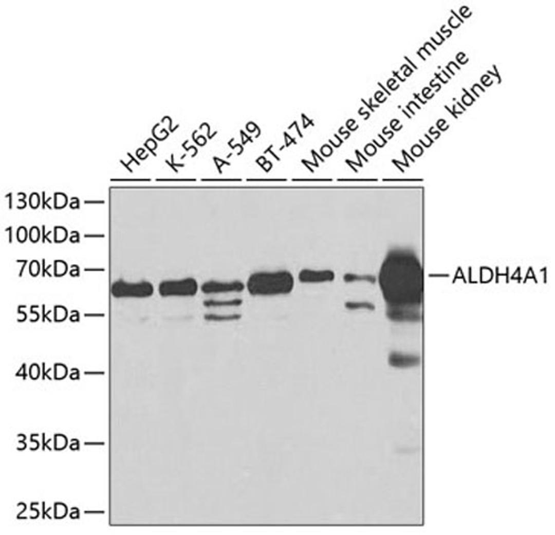 Western blot - ALDH4A1 antibody (A2595)