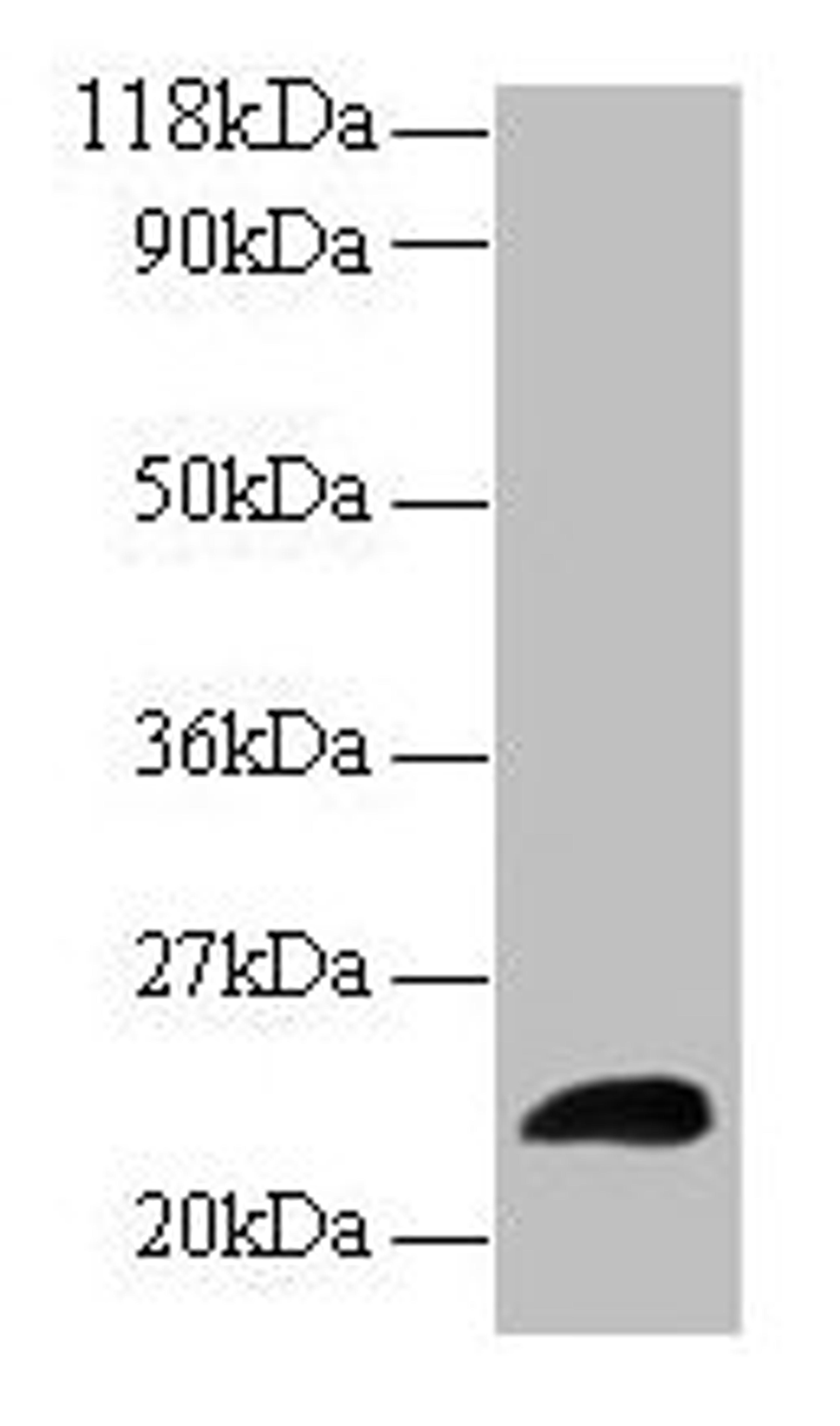 Western blot. All lanes: LCN2 antibody at 2µg/ml + Human positive serum. Secondary. Goat polyclonal to rabbit IgG at 1/15000 dilution. Predicted band size: 23 kDa. Observed band size: 23 kDa