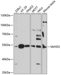 Western blot - SMYD3 antibody (A14516)